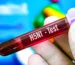 H5N1 Bird Flu Mutation Sparks Global Concern